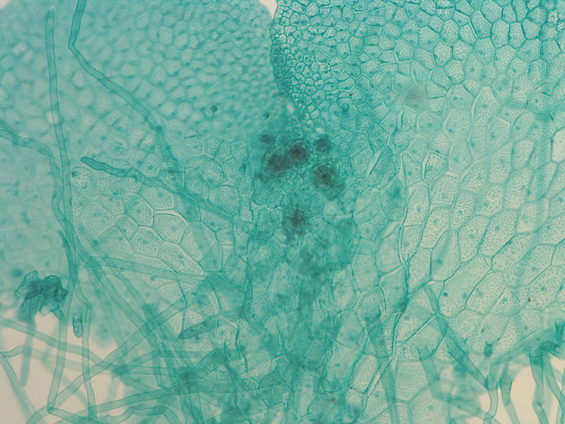 Fern Gametophyte Slides - Ferngametophyte 01 200X